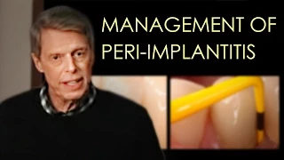 Management of Peri-implant Disease (Updated)