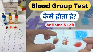 Blood Group Test in Hindi | Blood Group Test At Home@MLTLabManual2.0