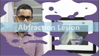 Management of Abfraction Lesions