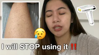 I will STOP USING Lescolton IPL (DIY Laser) in my legs | Ricalyn D.