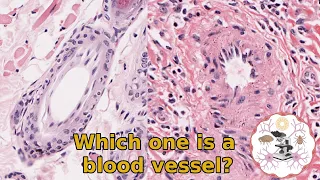 Blood Vessel Histology - Traps and Confusing Structures