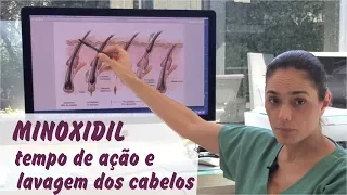 MINOXIDIL - tempo de ação no couro cabeludo e lavagem dos cabelos