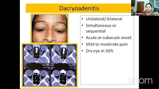 AIOC2021-GP41-Topic - Dr.JOYEETA DAS-Orbital inflammation