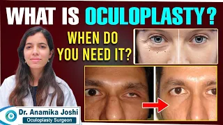 What is Oculoplasty? | Things you Need to Know About Oculoplastic Surgery | Best Vision Eye Hospital