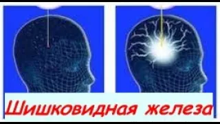 63.Шишковидная железа.Общение с Высшим Аспектом. Взаимоотношения России с Украиной. Дисбаланс России