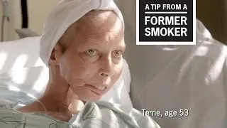 CDC: Tips From Former Smokers - Terrie H.: Surgeon General Ad