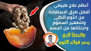 فوائد الثوم مع الكركم معجزة لعلاج الكلى وضعف وظائف الكلى افضل وصفة علمية مجربة للحصول على تنظيف عميق