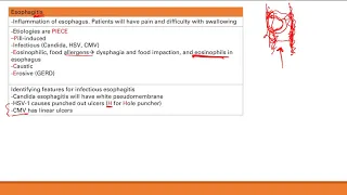 Esophagus Pathology | GI system | Step 1 Simplified
