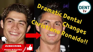 SMILE MAKEOVER 1. Cristiano Ronaldo's teeth changed!!(before&after) Cosmetic Dentistry Treatment.