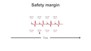 Pacemaker Issues Explained (Part 1): Understanding Failure to Capture