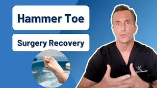 How Long Is Recovery From Hammer Toe Surgery?