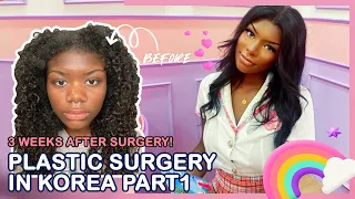 Jaylyn's (ethnic nose job)  Rhinoplasty and Facial Contouring Journey - Braun Plastic Surgery Korea