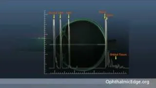 Lecture 4:How Does an A-Scan Become a B-Scan?