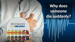 Why does someone "die suddenly"? - Barbara Brown, MSE and Dr. Tom Taylor