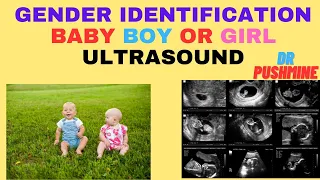 Gender Identification through Ultrasound Scanning | Baby Boy or Girl Ultrasound|