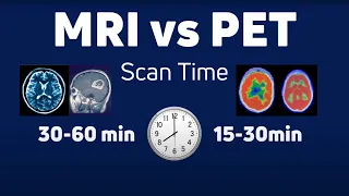 MRI vs PET: What's The Difference Between MRI and PET Scans?