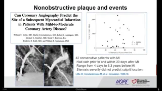 Victor Cheng, MD | CT Imaging of Coronary Artery Plaque: Substrate-based Approach to CAD