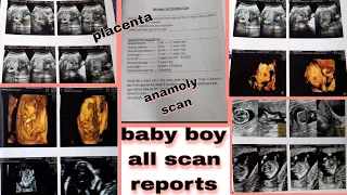 My baby boy all scan reports !! 100% true and real experience !!