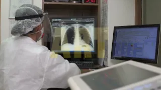 Doctor looks at X-ray of thorax on computer screen in office