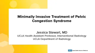 Minimally Invasive Treatment of Pelvic Congestion Syndrome