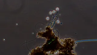 Anthophysa in Phase Contrast, BF and DF