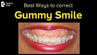 What are the different ways to correct gummy smiles? - Dr. Hussain Iqbal Wardhawala