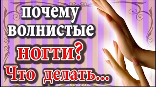 Почему ногти волнистые