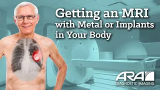 Getting an MRI with Metal or Implants in Your Body - ARA Diagnostic Imaging