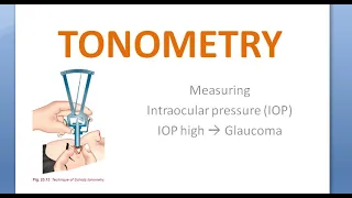 Ophthalmology Tonometry Indentation Schiotz Applanation Goldmann Types Tonometer