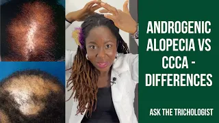 5 Differences between Androgenic Alopecia and CCCA | Ask The Trichologist Ep 13