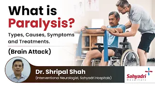 Things you should know about paralysis | Brain Stroke|  Brain Attack | Dr. Shripal Shah