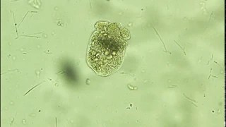 Echinococcus granulosus-sheep- protoscolex