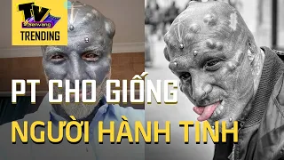 Anh chàng nổi tiếng vì muốn hóa thành người ngoài hành tinh