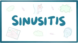 Sinusitis - causes, symptoms, diagnosis, treatment, pathology