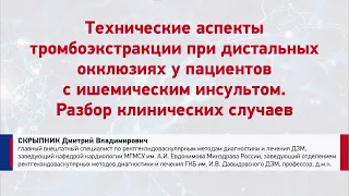 Скрыпник Д.В. Технические аспекты тромбоэкстракции при дистальных окклюзиях у пациентов с ИИ