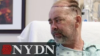 First Partial Skull and Scalp Transplant Completed at Texas Hospital
