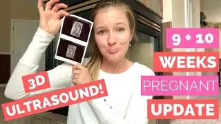 9 + 10 Week Pregnancy Update  |  3D ULTRASOUND!