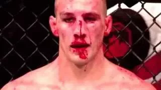 Rory Macdonald • Bloody Face