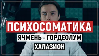 Психосоматика ячмень (гордеолум) и халазион на глазу. Новая Германская Медицина.