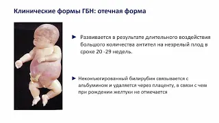Лекция № 7 Гемолитическая болезнь новорожденных