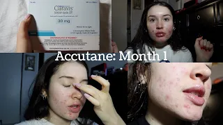 MY ACCUTANE JOURNEY: Month 1 Update