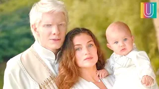 Modelo albino trae al mundo a bebé junto a su esposa morena