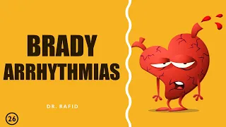 BRADYARRHYTHMIAS ◢◤ Dr. Rafid ◢◤ Lecture 26