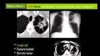 Chest (X ray chest ) Video by Mamdouh Mahfouz
