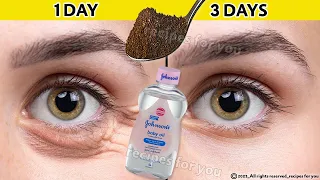 How To Get Rid of Eye Bags & Dark Circles in 3 Days | Remove Under Eye Bags and wrinkles Completely