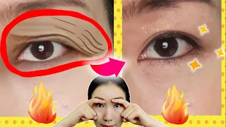 🔥Magic Shiatsu Massage &  Intense Exercises to Tighten Droopy Eyelids in 7 Days