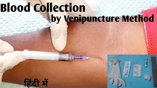 Blood Collection | Venipuncture Method |  Venipuncture procedure