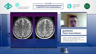 Деякі питання діагностики та терапії герпесвірусних нейроінфекцій (Дьяченко П.А.)