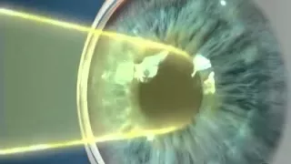 Зрачок глаза человека - строение и функции