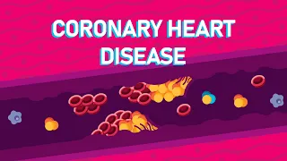 What Happens During A Heart Attack? - What is Coronary Heart Disease?